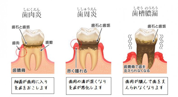 歯の説明